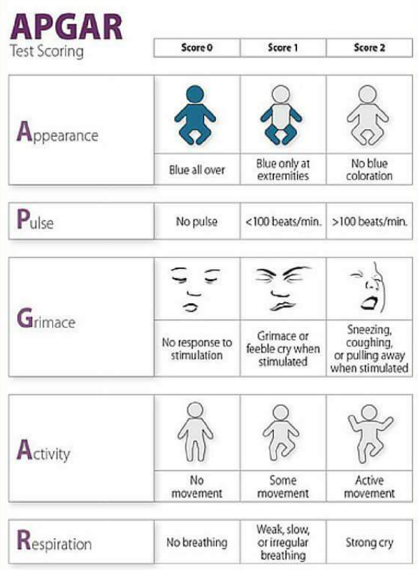 Apgar MasterMRCOG apgar-mastermrcog